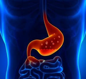 Leaky Gut