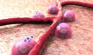 Damaged blood vessels